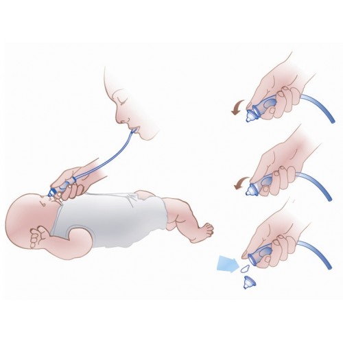 Aspirator nazal Baby ono